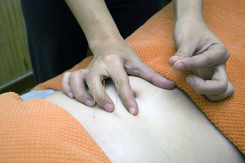 osteopathe-TARADEAU-min_acupuncture-4175625